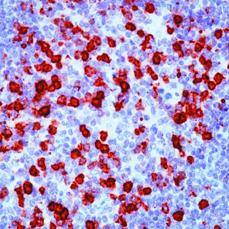 CD57 Antibody in Immunohistochemistry (Paraffin) (IHC (P))