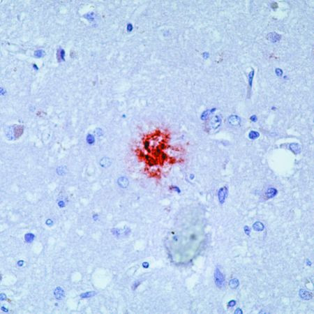 beta Amyloid Antibody in Immunohistochemistry (Paraffin) (IHC (P))