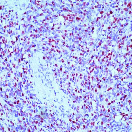 Myogenin Antibody in Immunohistochemistry (Paraffin) (IHC (P))