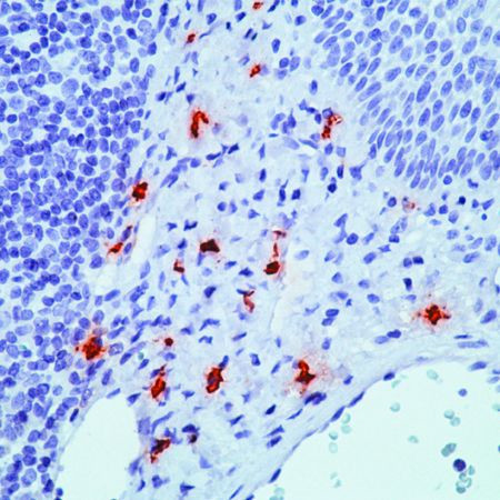 Tryptase Antibody in Immunohistochemistry (Paraffin) (IHC (P))