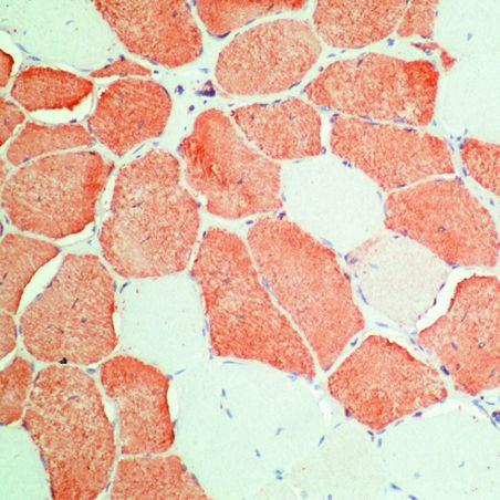 Myosin Skeletal Muscle Antibody in Immunohistochemistry (Paraffin) (IHC (P))