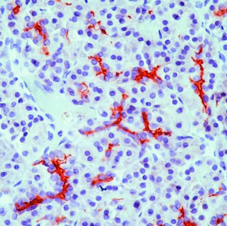 CFTR Antibody in Immunohistochemistry (Paraffin) (IHC (P))