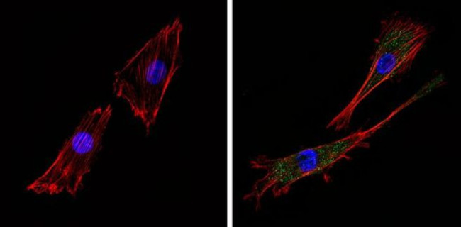 ARF6 Antibody in Immunocytochemistry (ICC/IF)