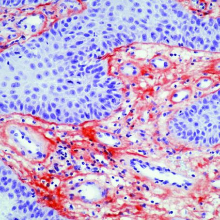 Tenascin C Antibody in Immunohistochemistry (IHC)