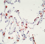 SFTPB Antibody in Immunohistochemistry (IHC)