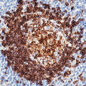 CD74 Antibody in Immunohistochemistry (Paraffin) (IHC (P))