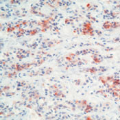 Prolactin Antibody in Immunohistochemistry (Paraffin) (IHC (P))
