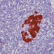 Insulin Antibody in Immunohistochemistry (Paraffin) (IHC (P))