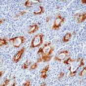 Thyroglobulin Antibody in Immunohistochemistry (IHC)