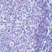 XPF Antibody in Immunohistochemistry (Paraffin) (IHC (P))