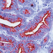 TAG72 Antibody in Immunohistochemistry (IHC)