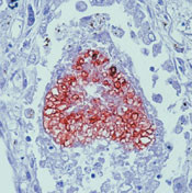 Pneumocystis jiroveci / carinii Antibody in Immunohistochemistry (IHC)