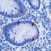 Serotonin Antibody in Immunohistochemistry (Paraffin) (IHC (P))