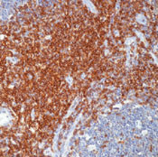 CD43 Antibody in Immunohistochemistry (Paraffin) (IHC (P))