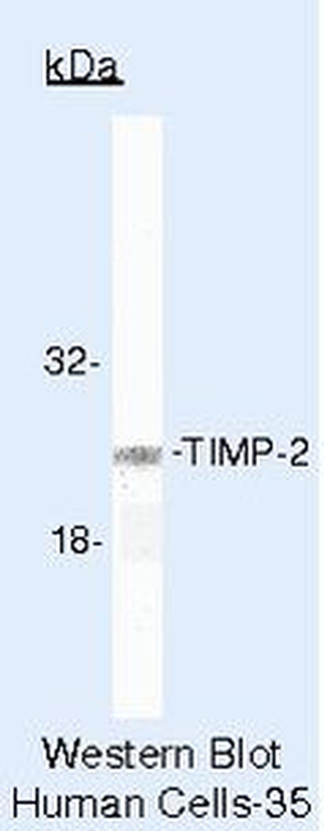 TIMP2 Antibody in Western Blot (WB)