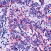 TIMP2 Antibody in Immunohistochemistry (Paraffin) (IHC (P))