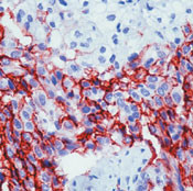 Mesothelioma Antibody in Immunohistochemistry (Paraffin) (IHC (P))