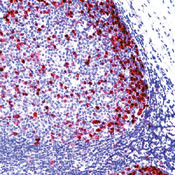 Pds1 Antibody in Immunohistochemistry (Paraffin) (IHC (P))
