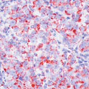 Myb Antibody in Immunohistochemistry (Paraffin) (IHC (P))