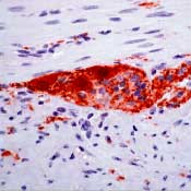 PGP9.5 Antibody in Immunohistochemistry (Paraffin) (IHC (P))
