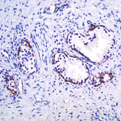 Maspin Antibody in Immunohistochemistry (IHC)