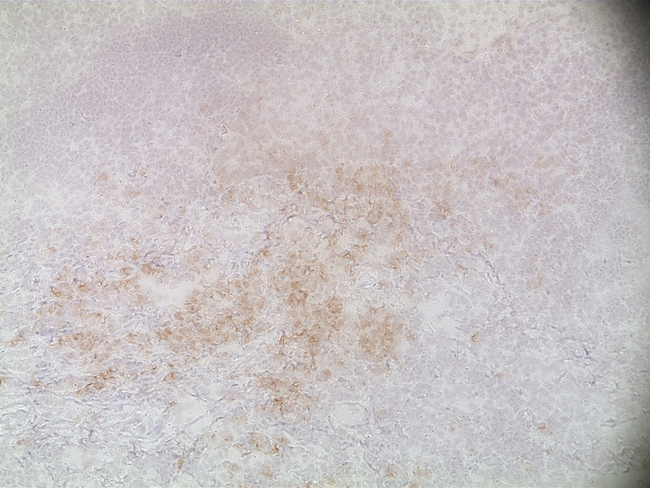 CD138 Antibody in Immunohistochemistry (Paraffin) (IHC (P))