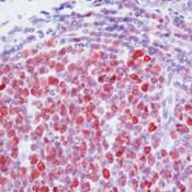 TOP2A Antibody in Immunohistochemistry (IHC)