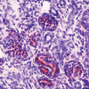 WT1 Antibody in Immunohistochemistry (IHC)