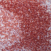 CD45RA Antibody in Immunohistochemistry (Paraffin) (IHC (P))