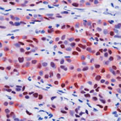 Calretinin Antibody in Immunohistochemistry (Paraffin) (IHC (P))