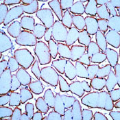 Dysferlin Antibody in Immunohistochemistry (IHC)
