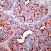Thyroid Cancer Marker Antibody in Immunohistochemistry (Paraffin) (IHC (P))
