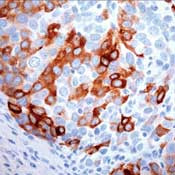 Mammaglobin A Antibody in Immunohistochemistry (IHC)