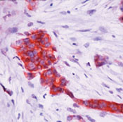 TFF1 Antibody in Immunohistochemistry (Paraffin) (IHC (P))