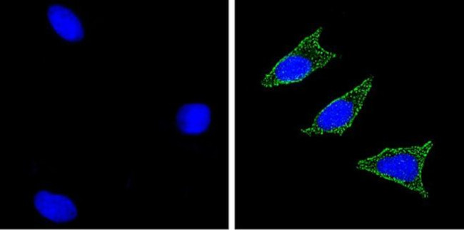 CD56 Antibody in Immunocytochemistry (ICC/IF)