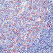 HDJ2 Antibody in Immunohistochemistry (Paraffin) (IHC (P))