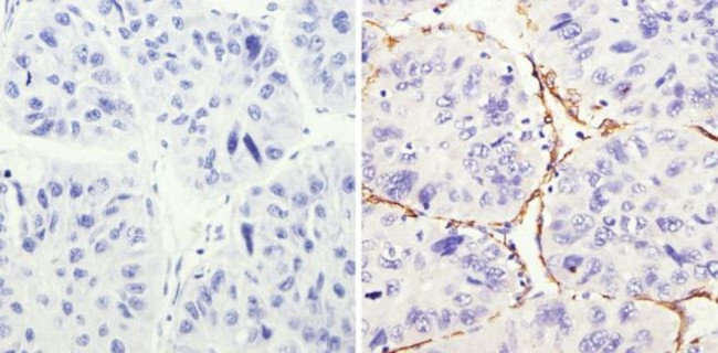AFP Antibody in Immunohistochemistry (Paraffin) (IHC (P))