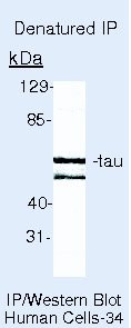 Tau Antibody in Immunoprecipitation (IP)