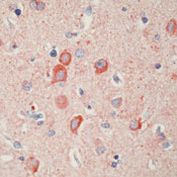 MAP1B Antibody in Immunohistochemistry (Paraffin) (IHC (P))