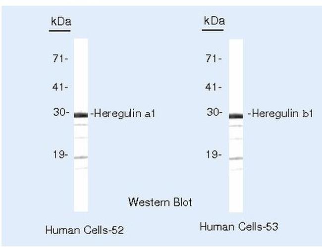 NRG1 Antibody in Western Blot (WB)