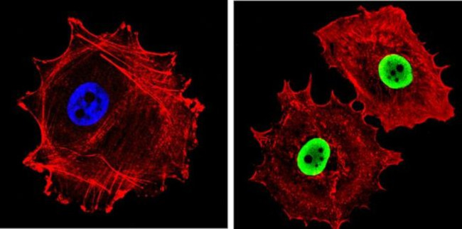 Ku70/Ku80 Antibody in Immunocytochemistry (ICC/IF)