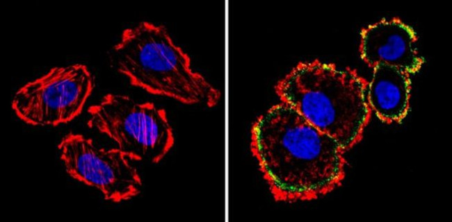 ErbB2 (HER-2) Antibody in Immunocytochemistry (ICC/IF)