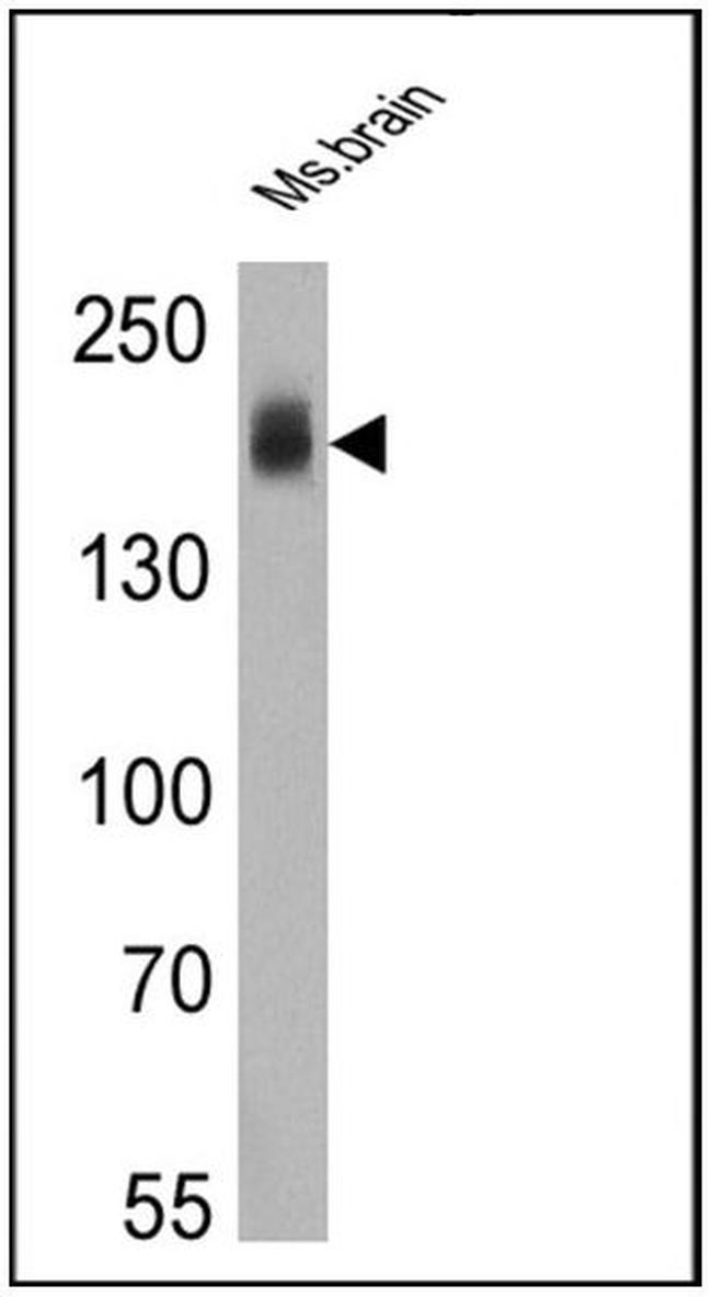 ErbB4 Antibody in Western Blot (WB)