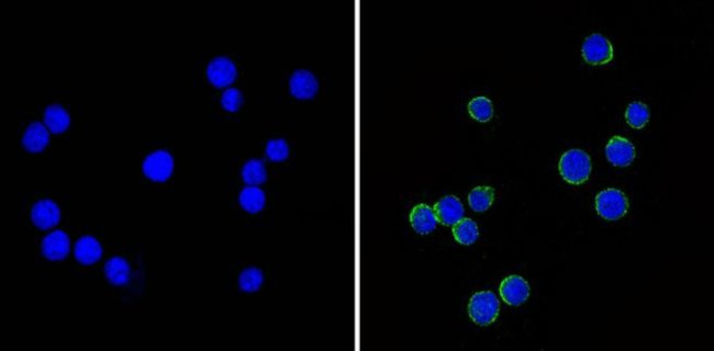 ICAM-1 Antibody in Immunocytochemistry (ICC/IF)