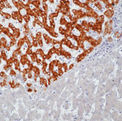 Hepatitis B Virus Surface Antibody in Immunohistochemistry (Paraffin) (IHC (P))