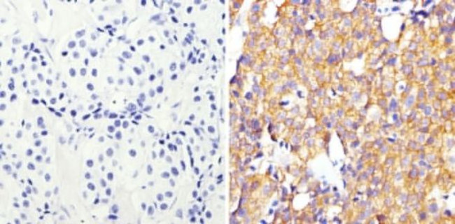 ErbB2 (HER-2) Antibody in Immunohistochemistry (Paraffin) (IHC (P))