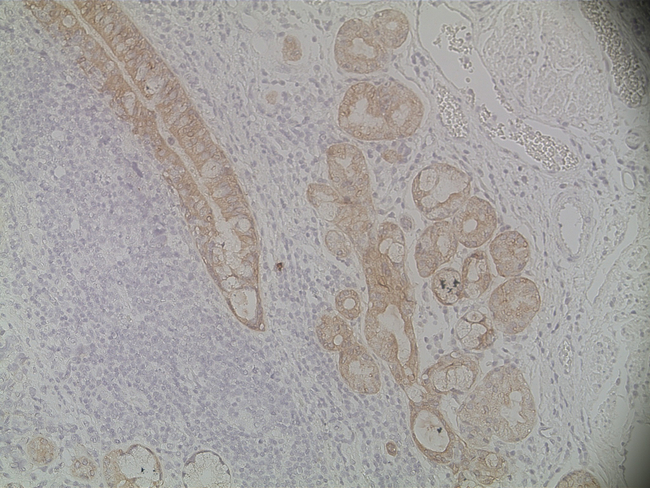 Cytokeratin Pan Type II Antibody in Immunohistochemistry (Paraffin) (IHC (P))