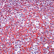 CD45 Antibody in Immunohistochemistry (Paraffin) (IHC (P))