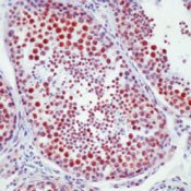 DNA-PK Antibody in Immunohistochemistry (Paraffin) (IHC (P))