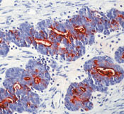 CA19-9 Antibody in Immunohistochemistry (Paraffin) (IHC (P))